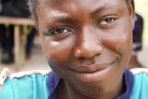 cataract girl