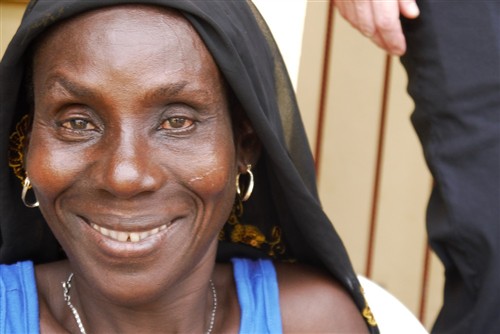 niger delta cataract patient