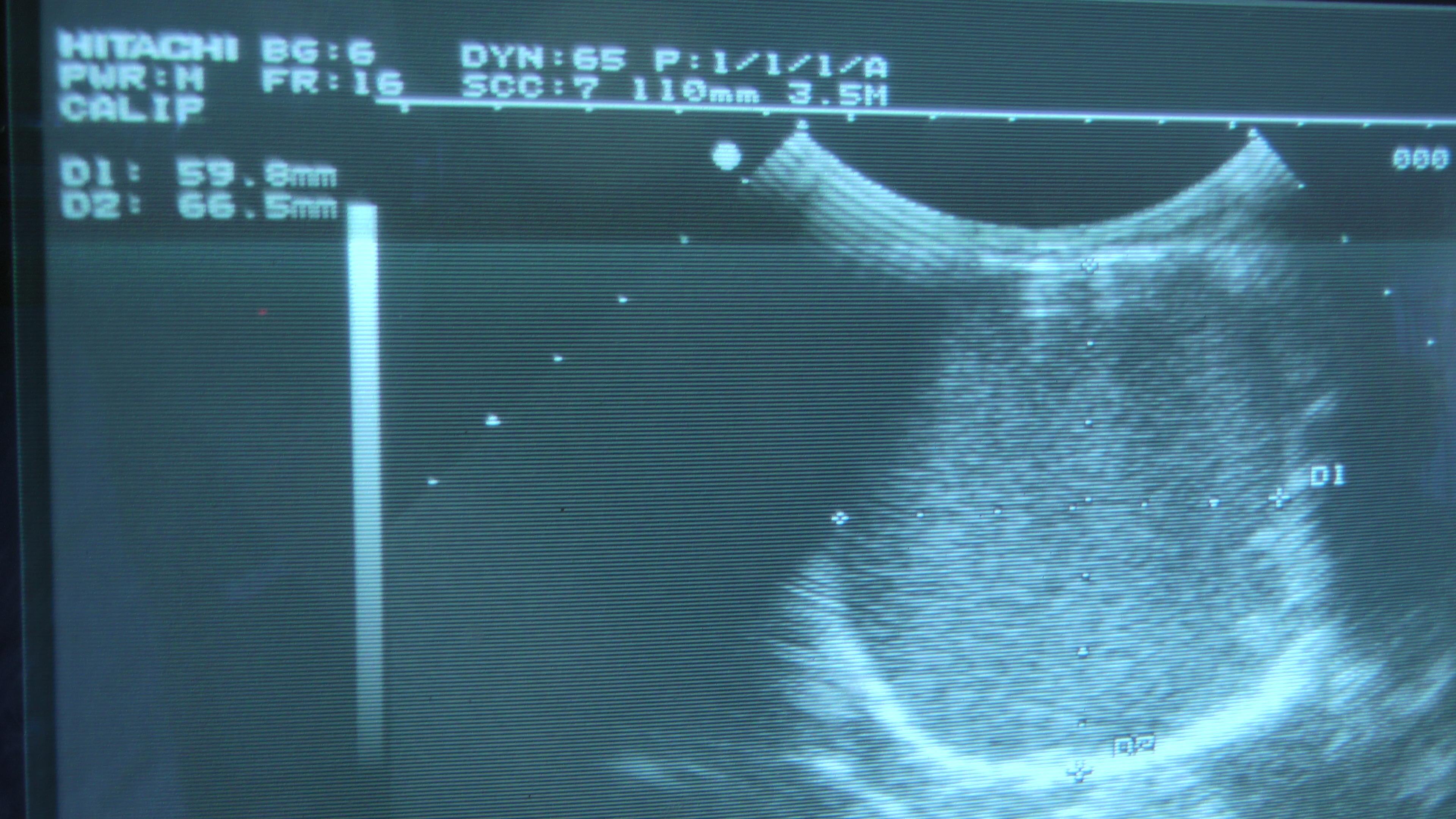 Ultrasound Image