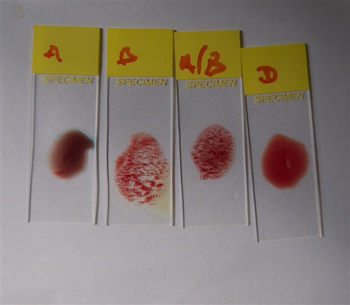 Blood Transfusion